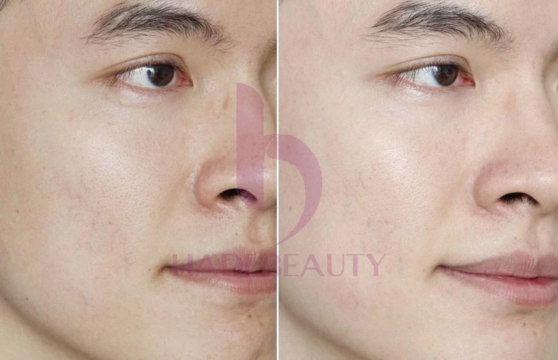 serum timeless review