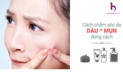 Sử dụng kem chống nắng nhằm ngăn ngừa mụn hiệu quả